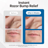 Razor Bumps Ingrown Hair Treatment: 3.38Fl.Oz Smoothing Solution for Body, Beard & Bikini Area Post Waxing after Shaving Serum for Ingrown Hair & Razor Burn - Women & Men